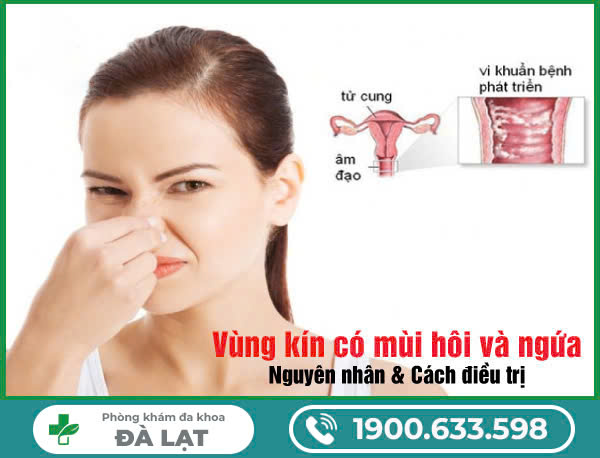Khám Chữa Âm Đạo Ngứa Có Mùi Hôi Tại Phòng Khám Đa Khoa Đà Lạt